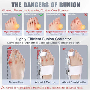 BuneeFix Bunion Corrector