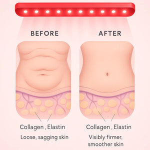 Lumeltiz Red Light Therapy Belt For Weight Loss