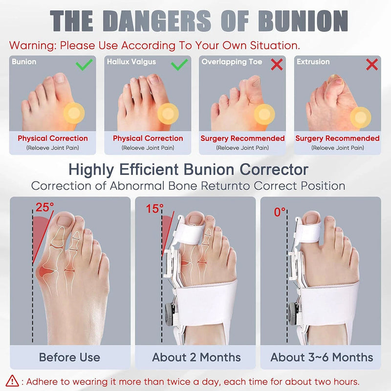 BuneeFix Bunion Corrector