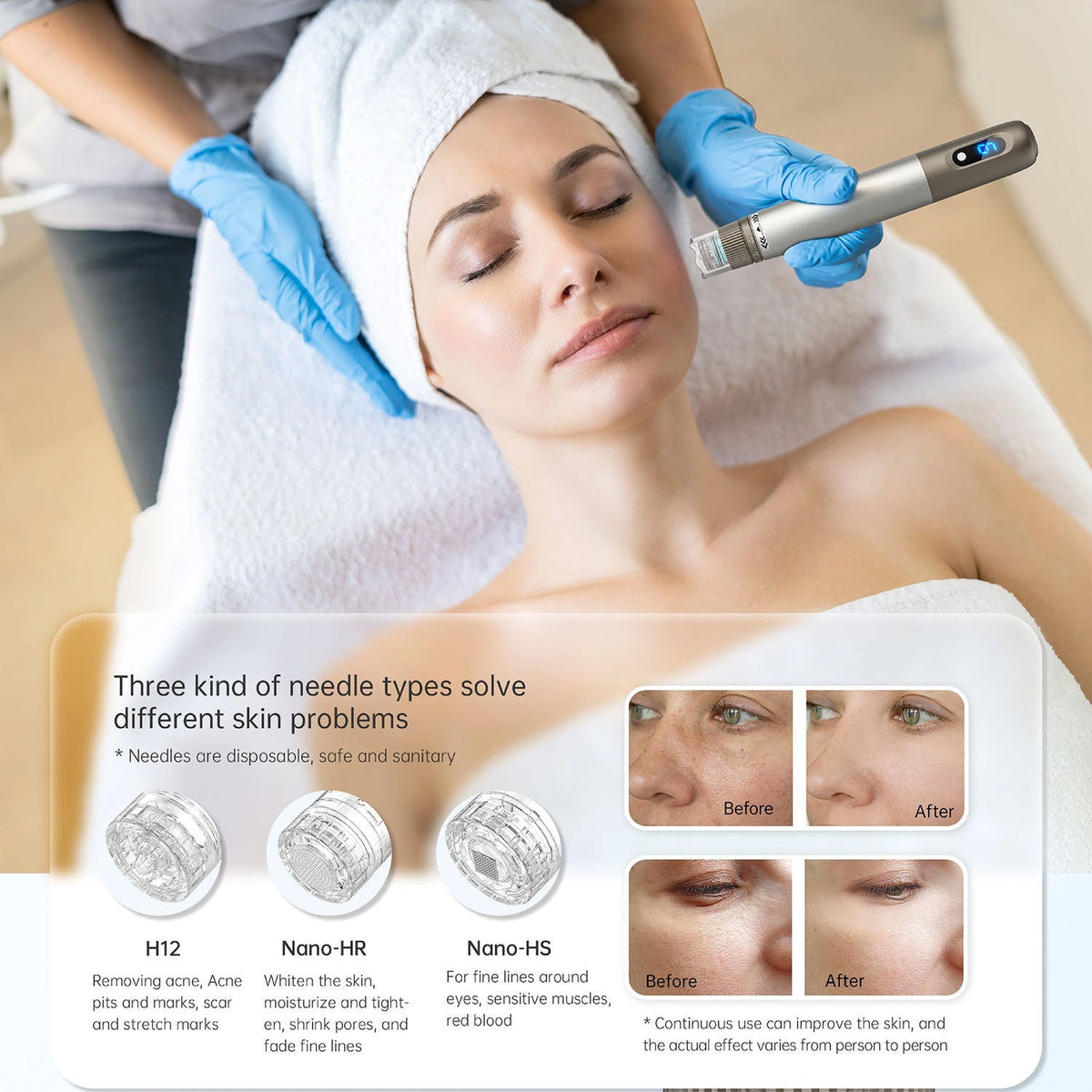 DermiPx